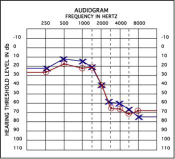 CHP - audiometric test chart