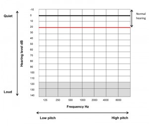 noise induced hearing loss - what does it look like
