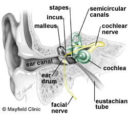 before an audiometric test